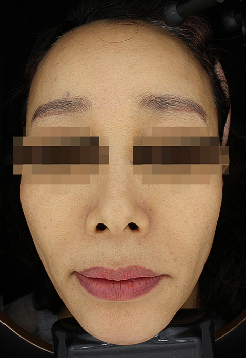 after이미지