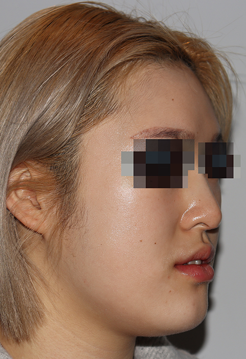 after이미지