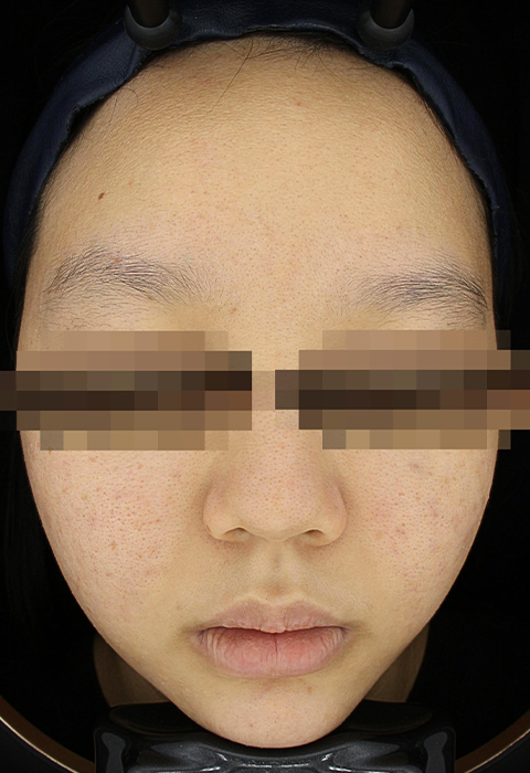 after이미지