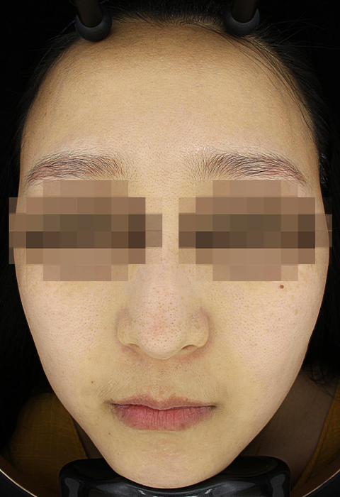after이미지