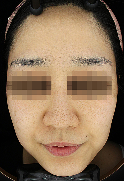 after이미지