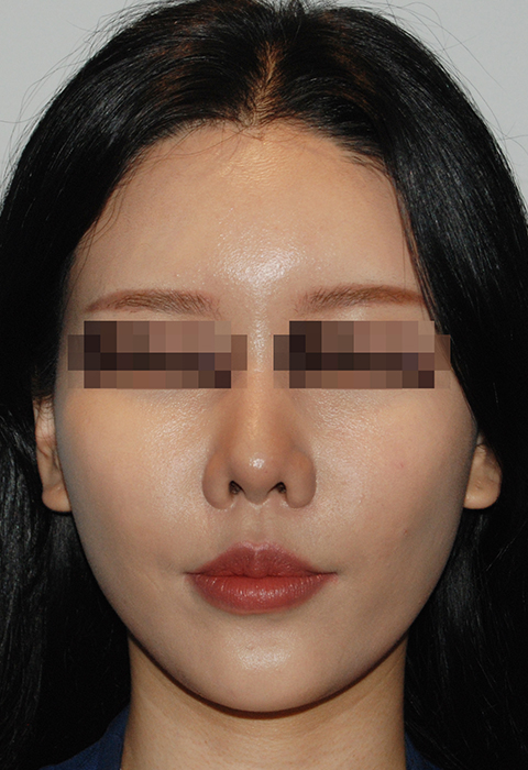 after이미지