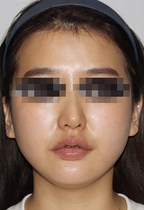 after이미지