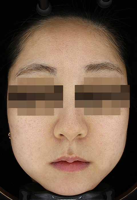 after이미지