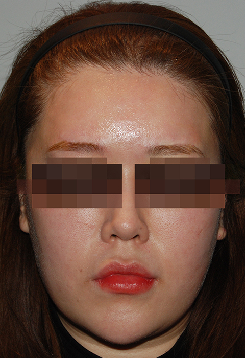 after이미지