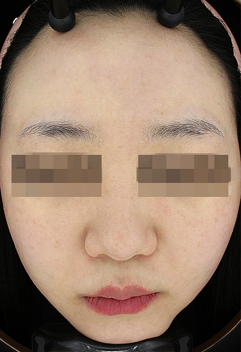 after이미지