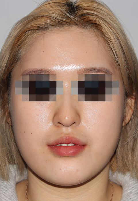 after이미지