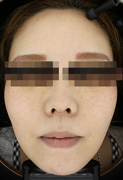 after이미지